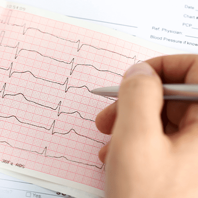 cardiac-safety-tqt-cardiac-assessment-header-v2