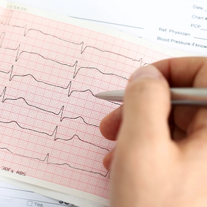 cardiac-safety-tqt-cardiac-assessment-header-v2